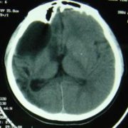 �����������̷���ﰸ��