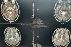 �ɹ������������������ ���� ���ִ�ů����ҽ���ϡ�������֮������������