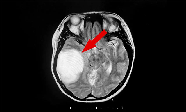 ҽѧǰ | ѮŮͷʹŻ¾­ھ޴ 򽨿˳г