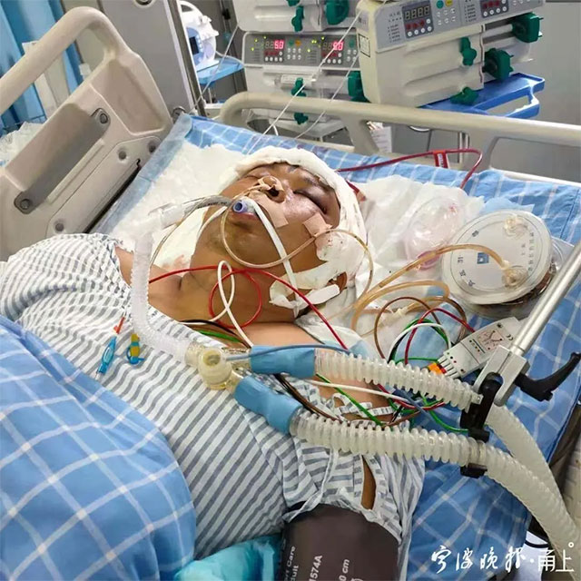 重度昏迷中的莫钢廷