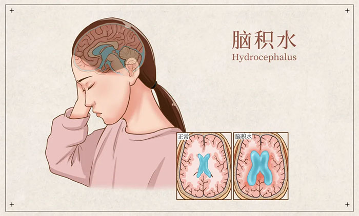 šˮ ޹ͨ¬ƺײʿ̸Իˮھ΢